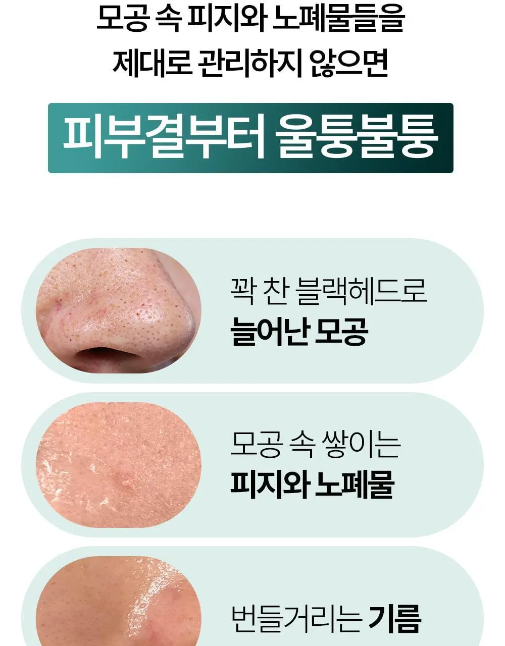 [블랙헤드제거] 야다 그린 티 퓨어 클렌징 밤 100ml 상세페이지 8